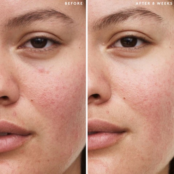 Fenty Skin Travel-Size Start’r Set  Dry Skin Edition NEW - Picture 7 of 10